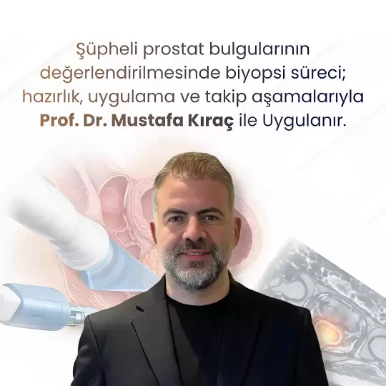 Prostat görseli